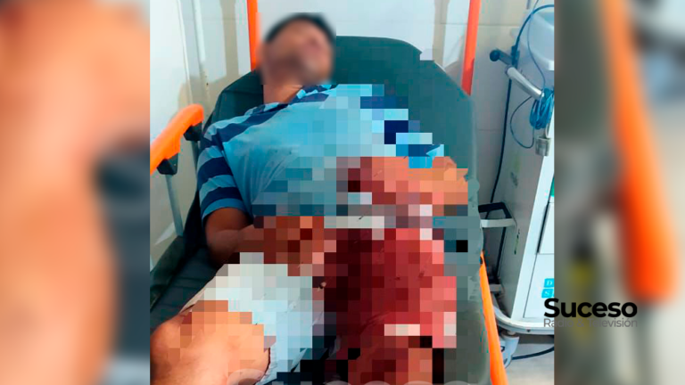 Un hombre de 45 años resultó gravemente herido en la madrugada de ayer, tras una discusión