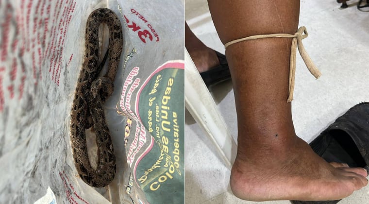 La víctima fue mordida por una yarará mientras se encontraba de pesca. Foto: Gentileza.