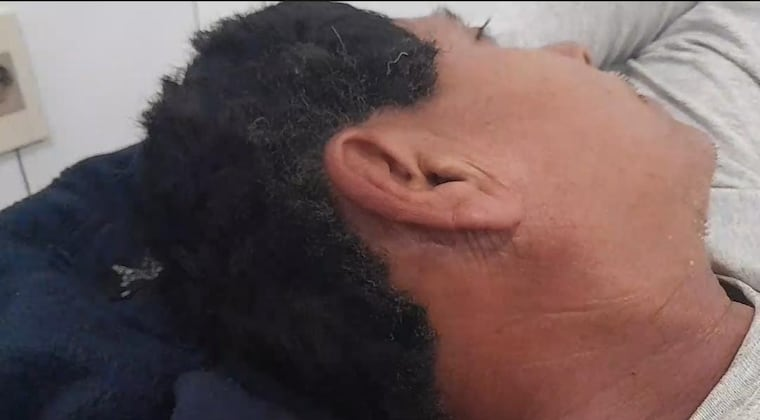 Hombre sobrevive tras el impacto de un rayo en Canindeyú