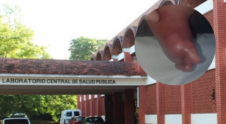 La beba sufre una trombosis a raíz de un mal procedimiento médico en Lacimet, según denuncian.